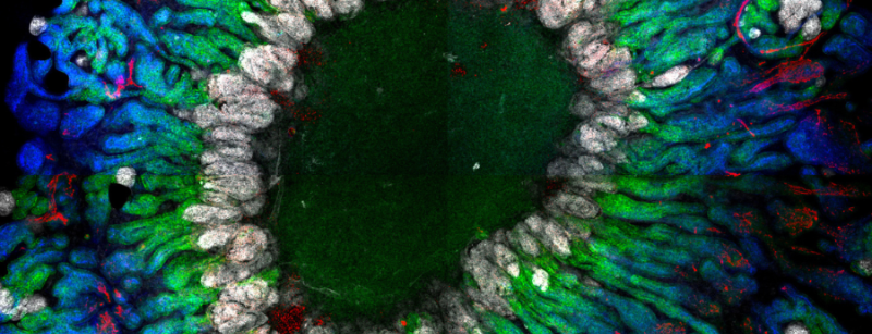 Image of a mini kidney organoid