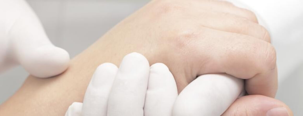 Persons hand being examined