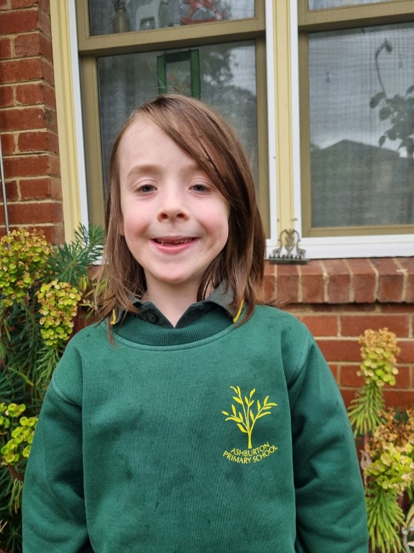Thomas, 7, has stopped snoring after taking part in the MIST trial