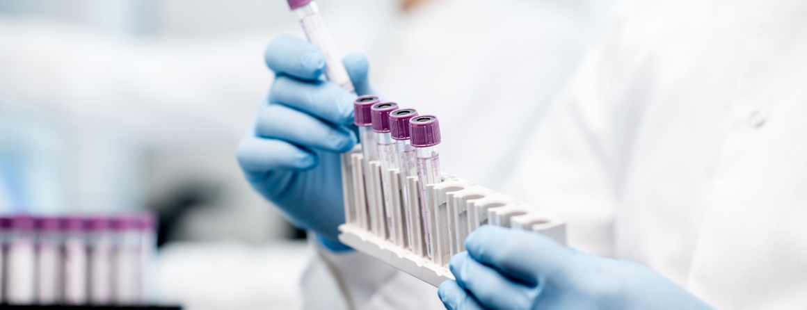 A scientist holding test tubes