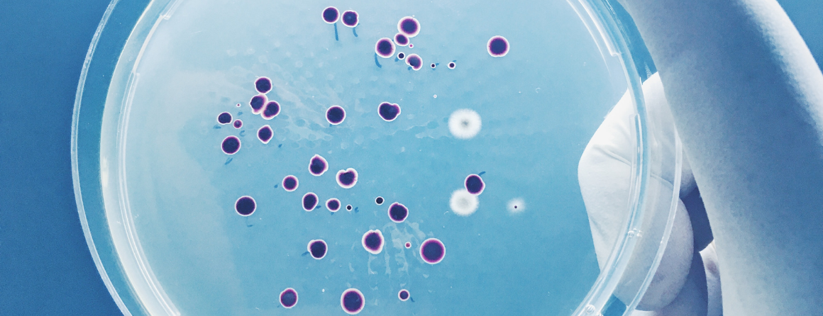 Petri dish