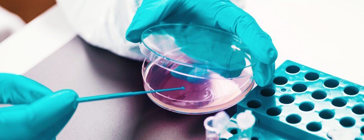 A researcher with a petri dish