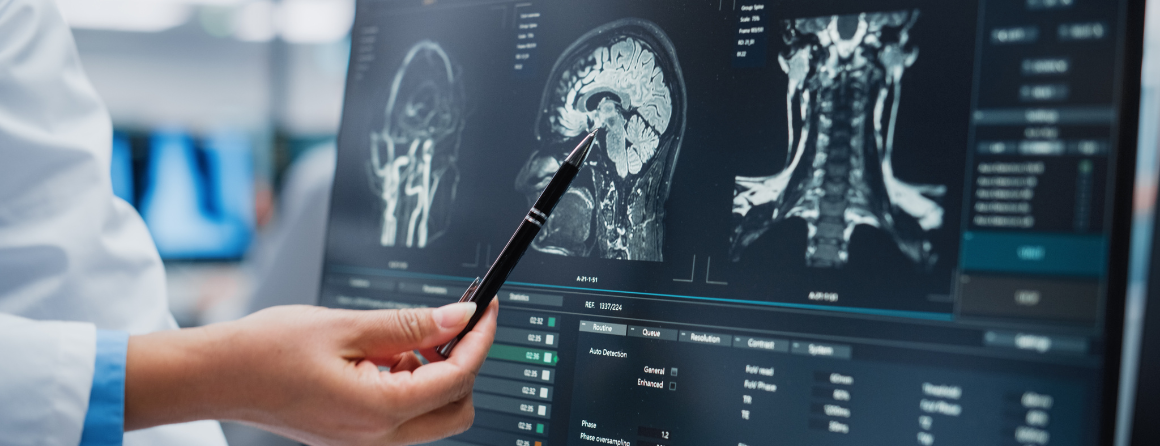 A brain researcher looking at scans