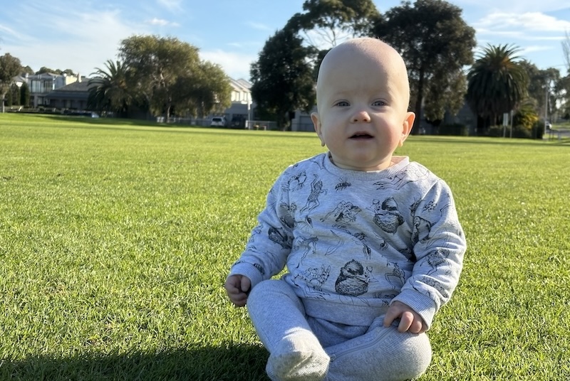 Teddy who was born preterm