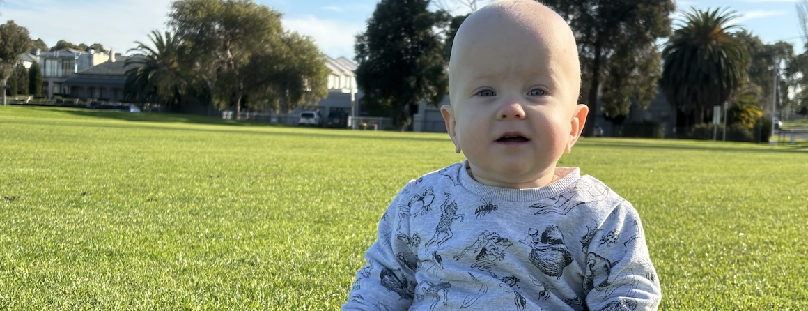 Preterm baby Teddy