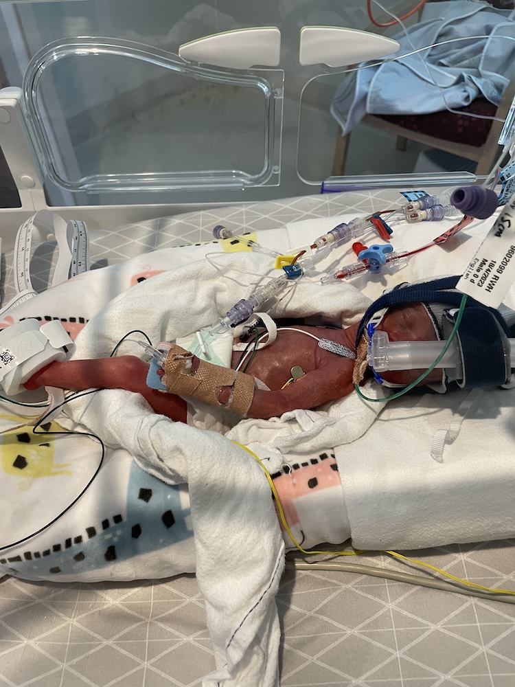 Teddy NICU