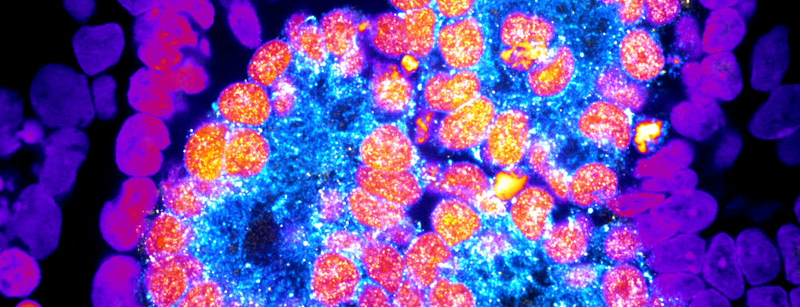 Credit for the photo: A glomerulus, the main filtering unit of the kidney, in a stem cell-derived kidney tissue. MCRI’s Dr Aude Dorison, Rachel Lam and Irene Ghobrial, kidney regeneration lab.