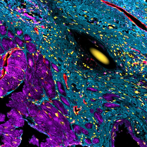 An animal model of heart failure treated with lab-grown human heart muscle. Credit: Hayley Pointer and Rebecca Sutton, MCRI Research Assistants, Heart Regeneration and Disease Groups