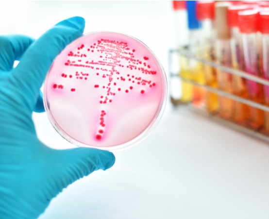 Scientist examining petri dish