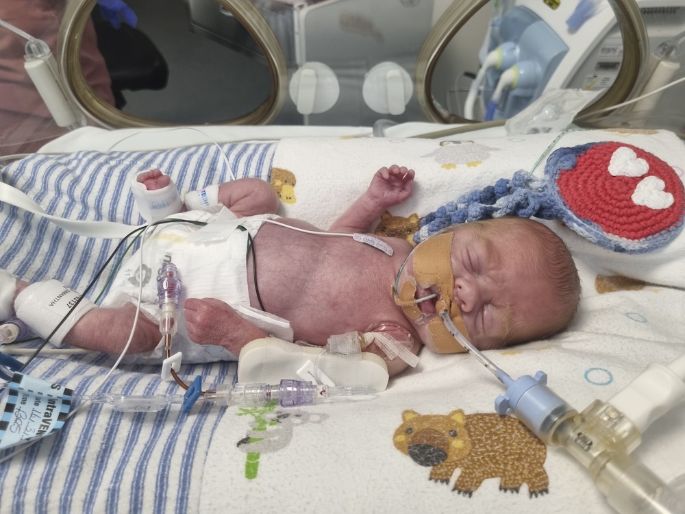 Atticus in the NICU with chronic lung disease