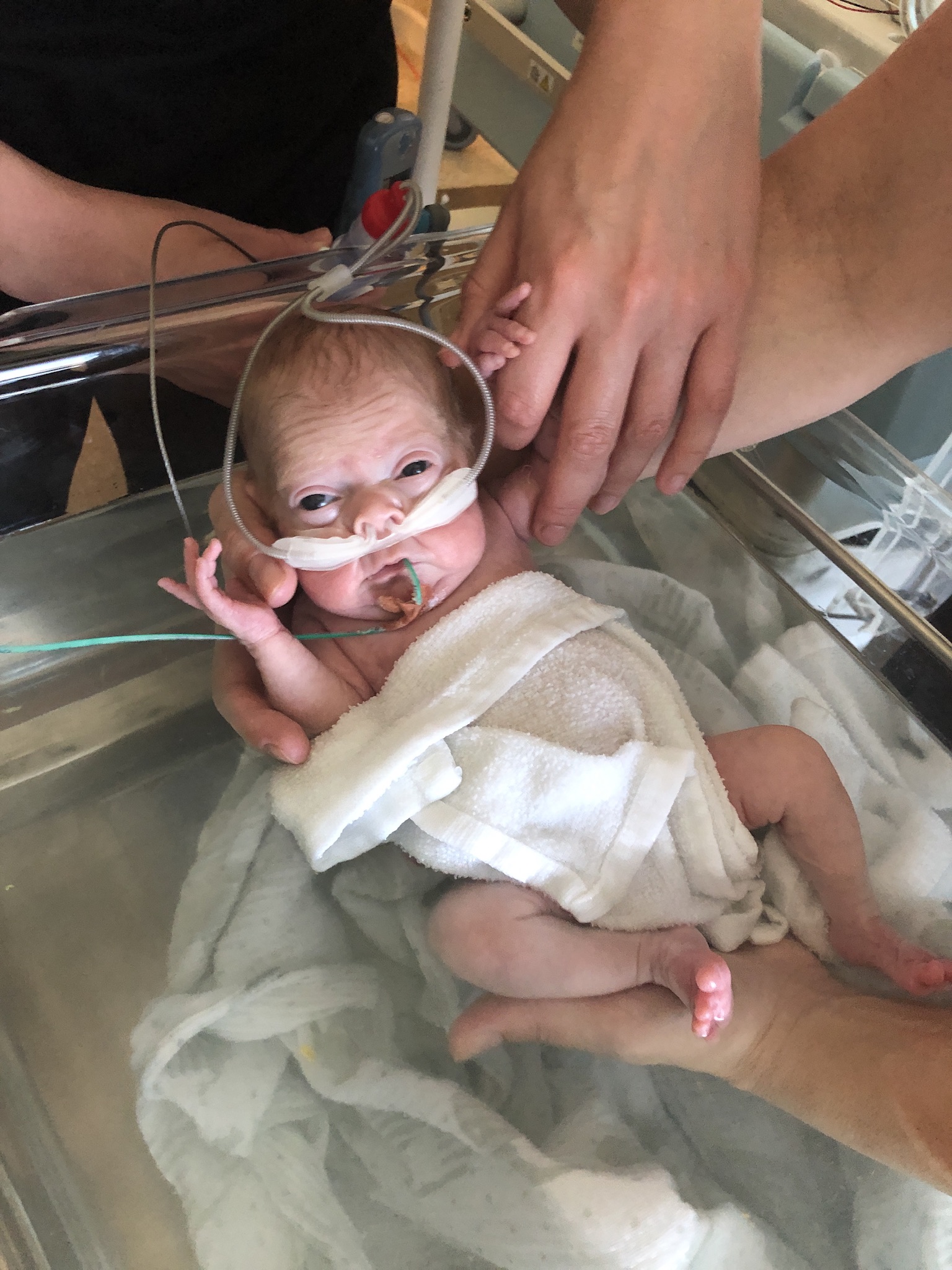 MCRI Milly neonatal respiratory research