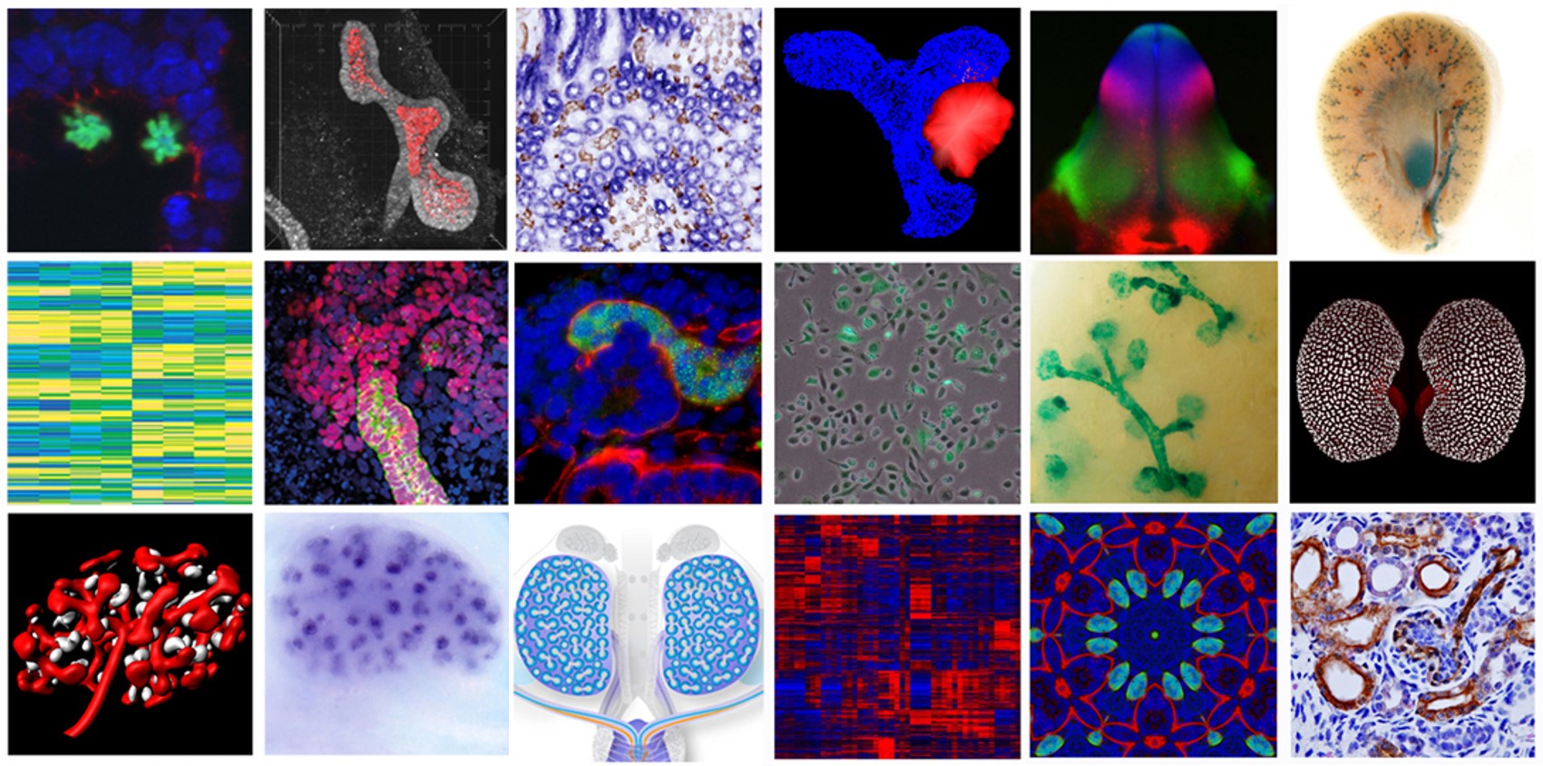 kidney research biology slides