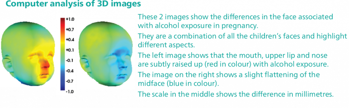 head size image