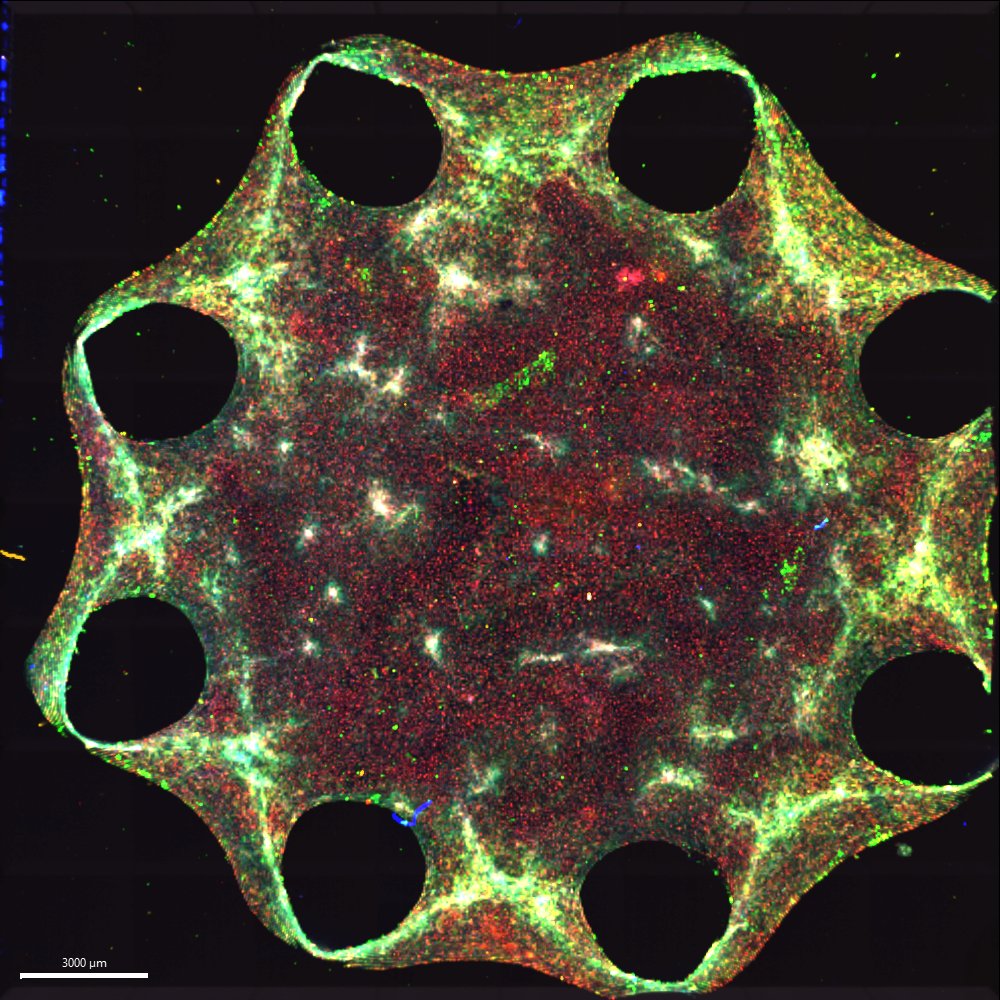 Bioengineered heart valve tissue. Credit: Jessica Durrant-Whyte, Heart Regeneration.