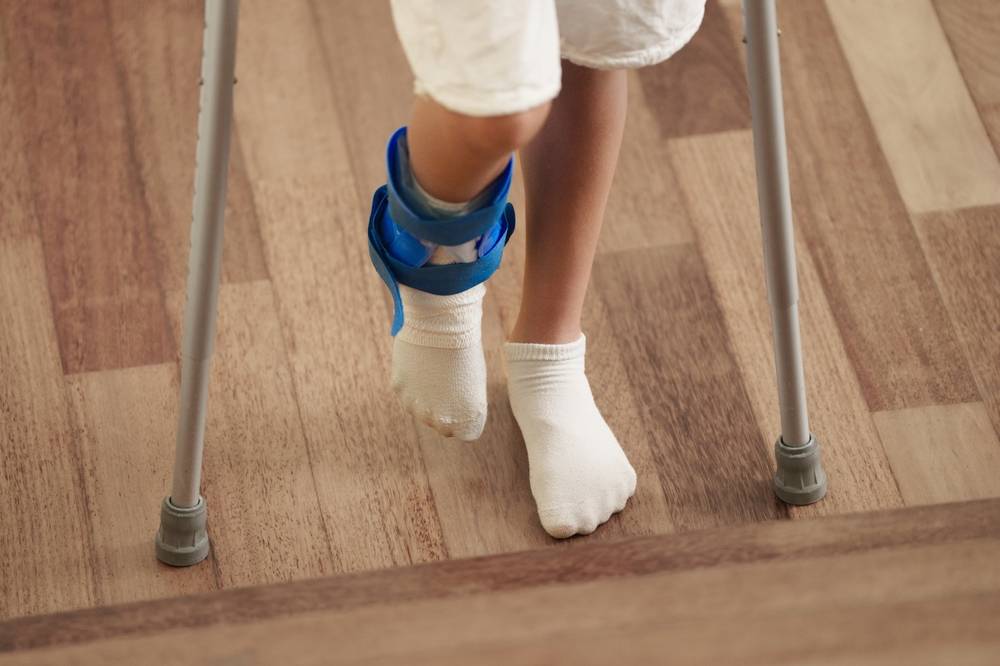 child limping on crutches