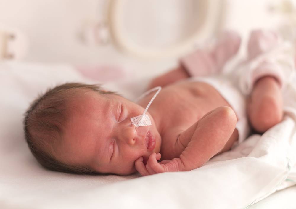 baby in hospital with NGT