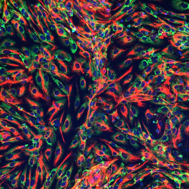 Heart valve cells derived from stem cells. Credit: Dr Holly Voges, Heart Regeneration.