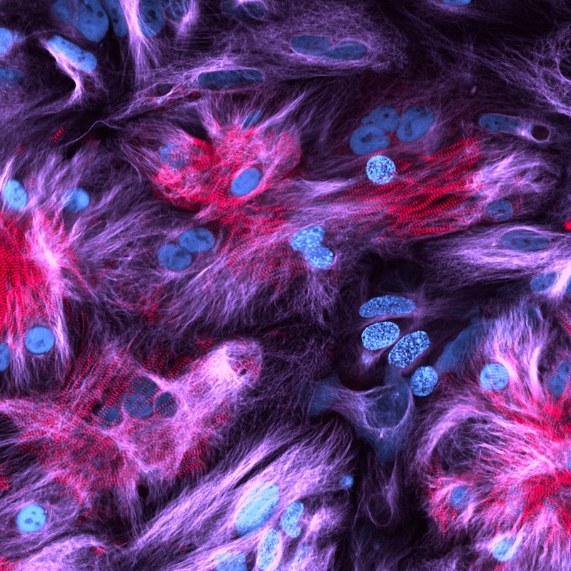 Proliferation (blue) of heart muscle cells (red) in a stem cell derived 2D cardiac model. 