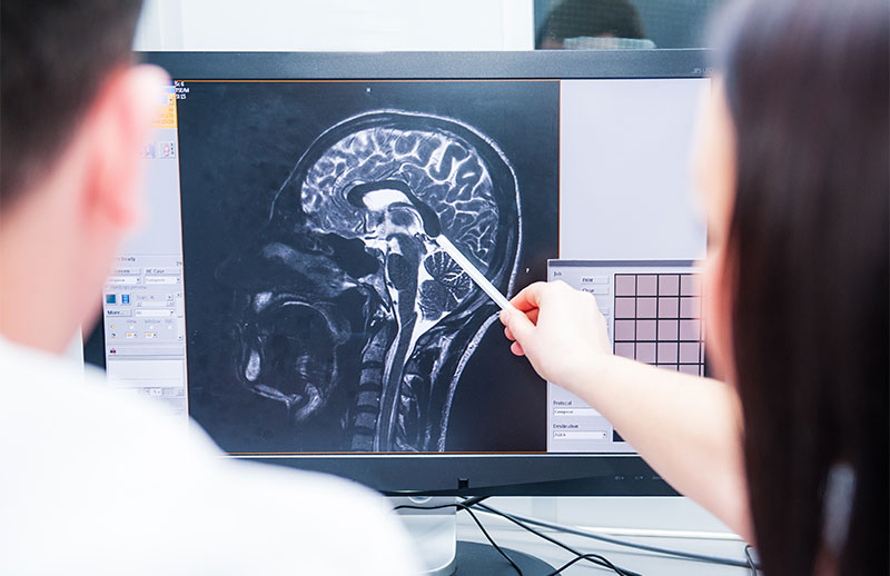 Researchers looking at brain scan