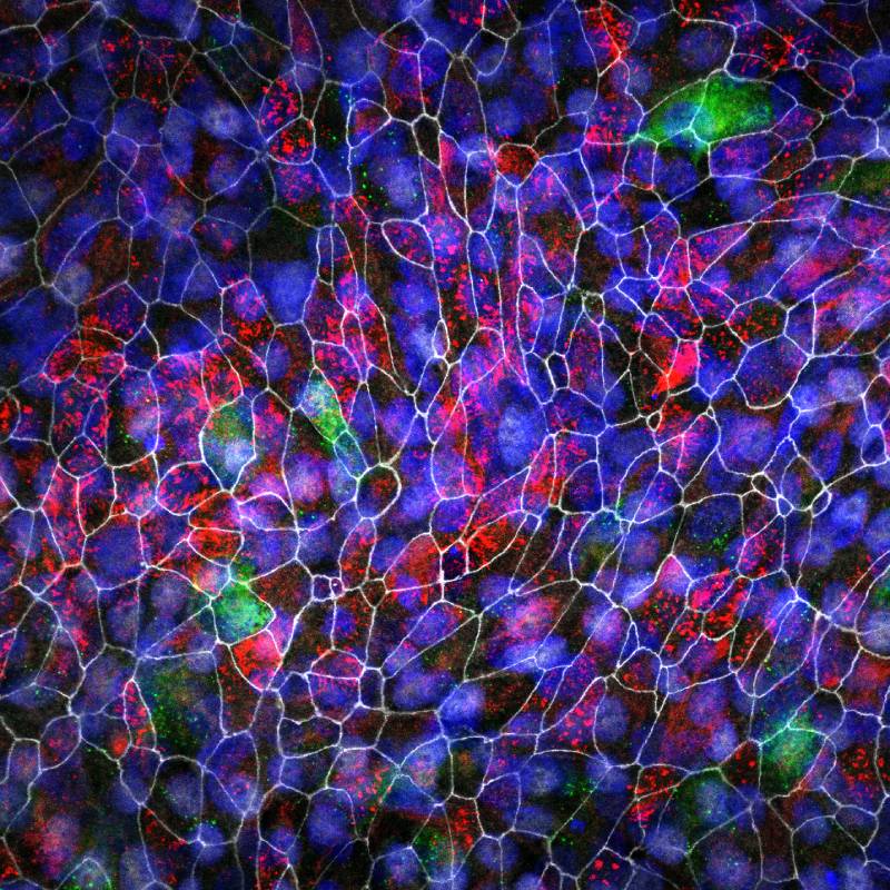 Lung Disease Group Cystic Fibrosis 800x800