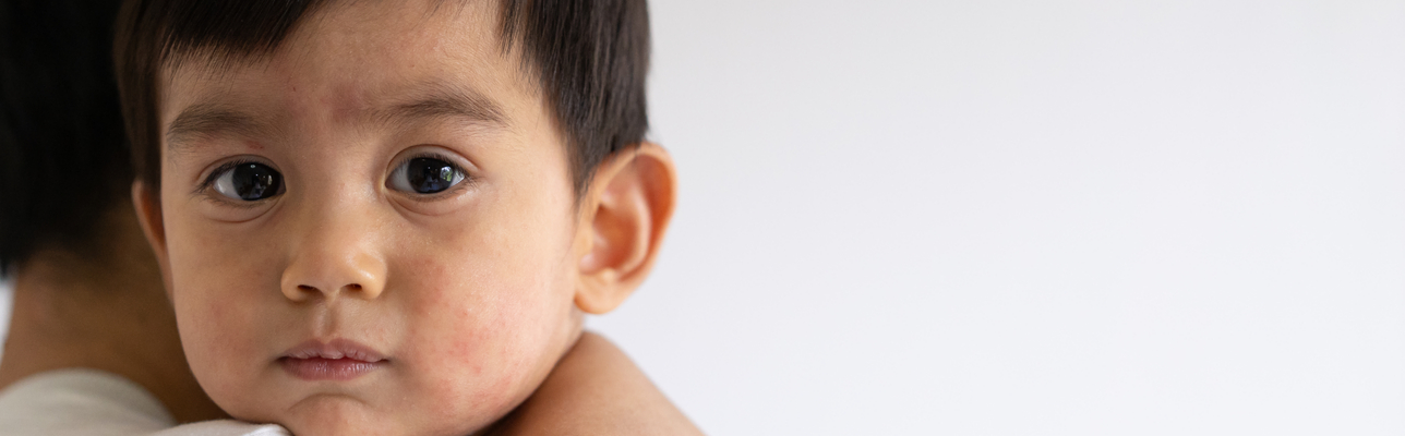 Child unwell