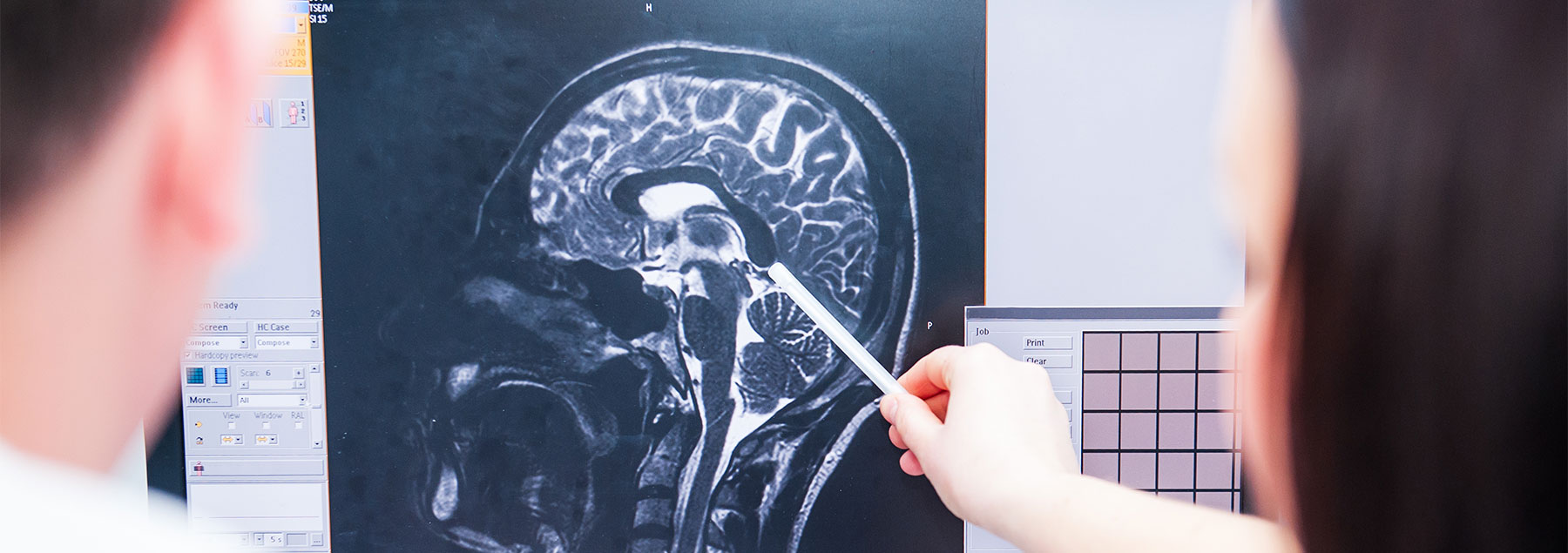 Researchers examining an MRI
