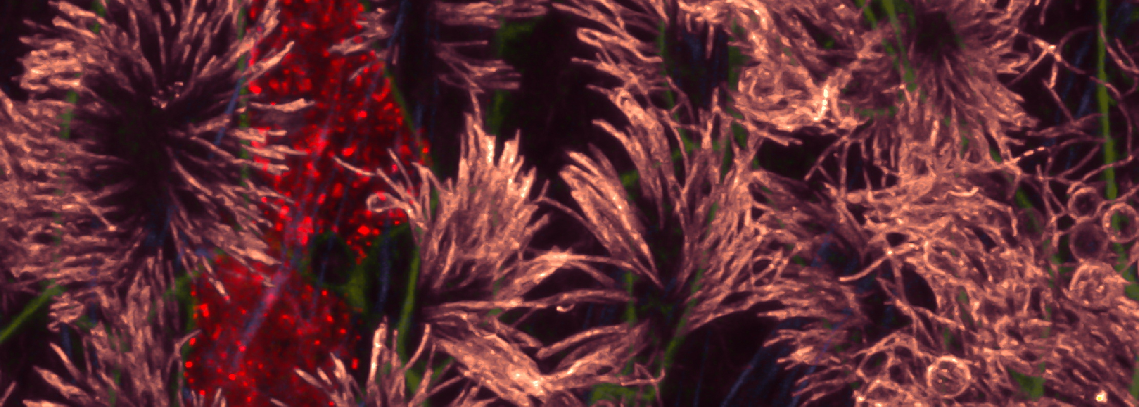 Banner image: Stem cell-derived lung cells. Photo courtesy of Dr Declan Turner, Postdoctoral Researcher, Lung Disease group. 